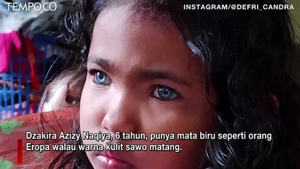 Viral, Anak Bermata Biru dari Pekanbaru dan Sulawesi Tenggara