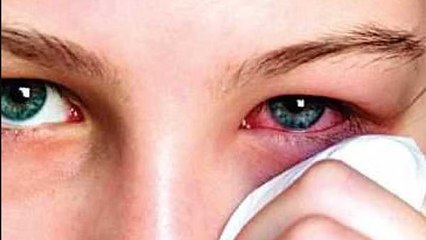 आंखों में काले धब्बों का होना है बेहद गंभीर समस्या,जानिए कारण। Boldsky *Religious