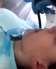 Hastanın midesinden yılan çıkarıldı!