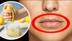 होठों के आसपास काले धब्बे होने का कारण | होठों के आसपास काले धब्बे दूर करने के उपाय | Boldsky