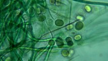 Tampons aus Algen (1)