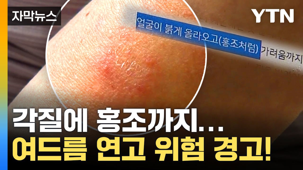 [자막뉴스] 불법 성분 들어있는 여드름 연고, 해외 직구 통해 국내로... / YTN