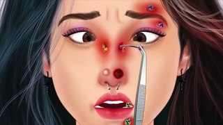 ASMR Treatment of infections caused by wearing facial piercings - 얼굴 피어싱 착용으로 인한 감염 치료 animesh playing trainding best asmr video