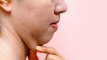चेहरे की चरबी क्यों बढ़ती है, चेहरे की चरबी कैसे कम करें |Boldsky*Health
