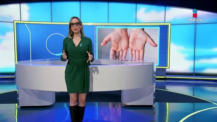 Viruela del mono mantiene tendencia a la disminución: Secretaría de Salud