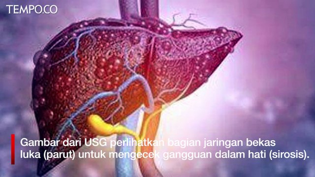 USG Tak Hanya untuk Tes Kehamilan, tapi juga Pemeriksaan Hepatitis