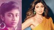 Bollywood Actresses जो Plastic Surgery के बाद भी दिखती हैं बेहद ख़ूबसूरत | Boldsky *Entertainment