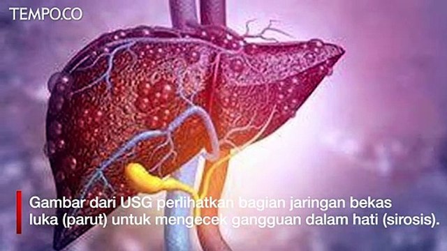 USG Tak Hanya untuk Tes Kehamilan, tapi juga Pemeriksaan Hepatitis