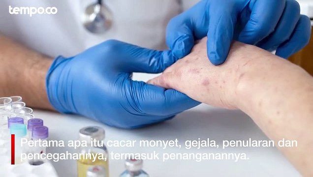 Masih Merebak, Perlunya Sosialisasi Menyeluruh tentang Cacar Monyet