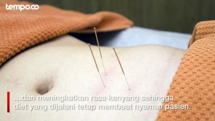 Atasi Masalah Obesitas dengan Akupunktur