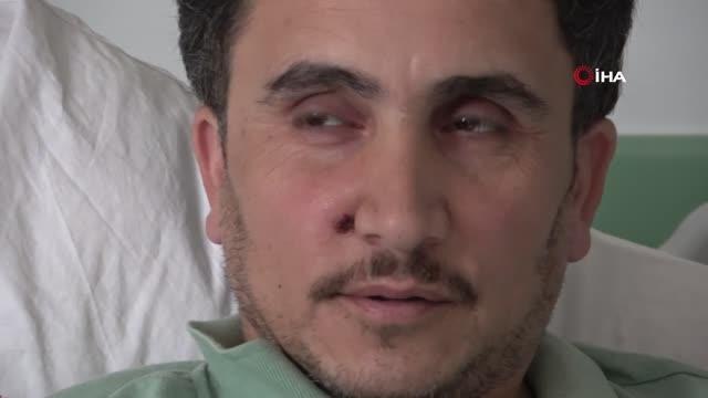 Yüzüne inşaat demiri saplanan işçinin tedavisi tamamlandı