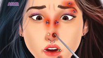 ASMR Treatment Removing Parasites from Face Oddly satisfying 3D Animation @ASMR