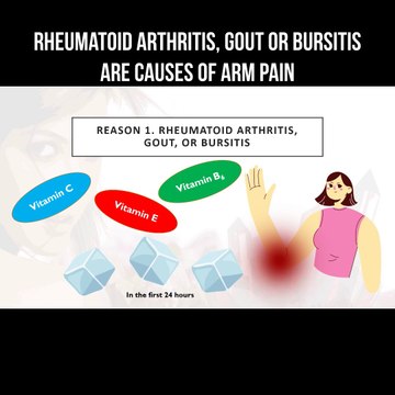 Rheumatoid arthritis, gout or bursitis are causes of arm pain