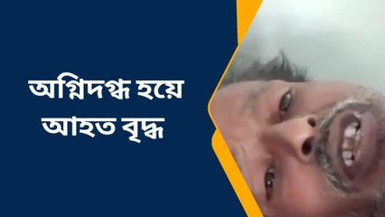 পূর্ব বর্ধমান: আগুন পোহাতে গিয়ে জ্বলে উঠল শরীর!