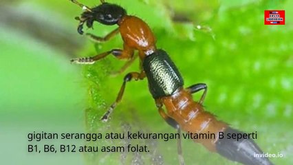 KETAHUI PENYEBAB KESEMUTAN YANG SERING TERJADI