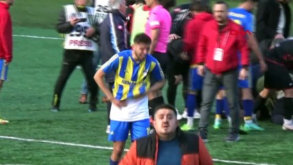 Futbolcular çarpıştı: Kalecinin kafa kemiklerinde kırıklar var