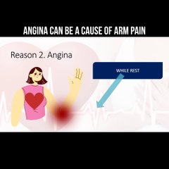 Angina can be a cause of arm pain
