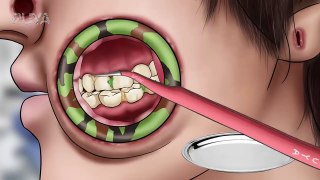 ASMR Cleaning big hole swollen face piercings _ Removal animation