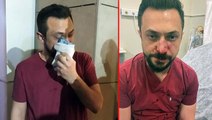 Şanlıurfa'da hasta yakını saldırdığı doktorun burnunu kırdı