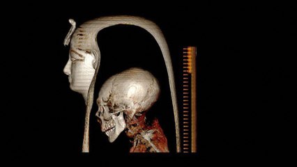 Histoire : des scientifiques "déballent" numériquement la momie d'Amenhotep Ier en Égypte