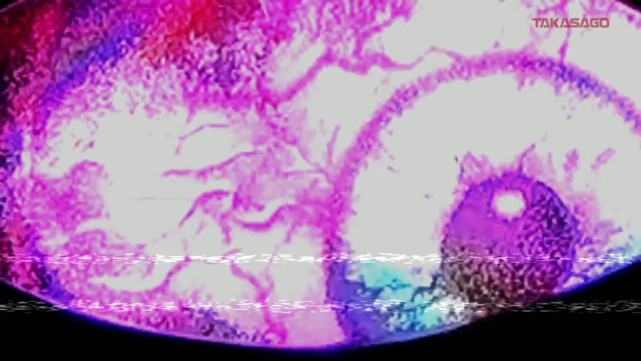 Silent Hill - Teaser zum Horror-Spielautomat