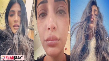 Shruti Haasan ने सूजी आंख और No Makeup वाला look दिखाया, Fans कर रहे जमकर तारीफ! FilmiBeat