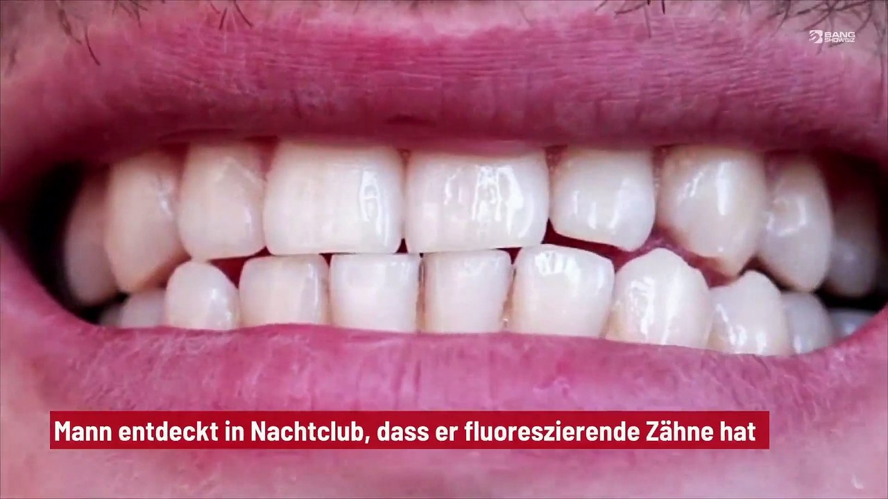 Mann entdeckt in Nachtclub, dass er fluoreszierende Zähne hat