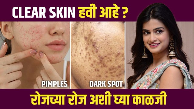 Clear स्किनसाठी सोपं Routine | How to Get Clear Skin Naturally | Skincare tips | Lokmat Sakhi