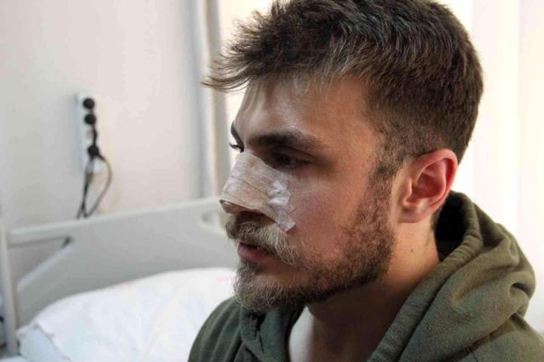  zmir de Darp Edilen Asistan Doktorun Burnu K r ld Dailymotion Video
