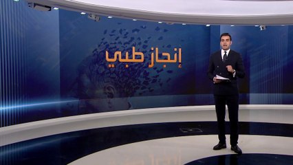 "ليكانيماب".. عقار واعد لعلاج مرض الزهايمر