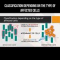 Classification of the cancer depending on the type of affected cells