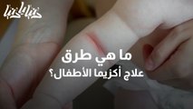 ما هي طرق علاج أكزيما الأطفال وما هي سبب الإصابة بها؟