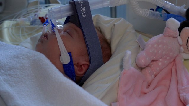 Epidémie de Bronchiolite : «Il faut garder un lit, on est obligé d’annuler l’opération du petit Léo»