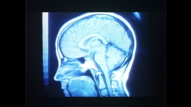 Brain Dead Bande-annonce (EN)