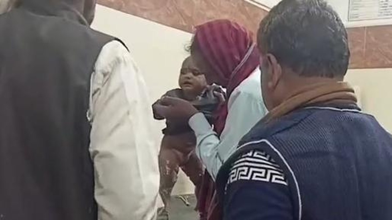 मुरैना: खौलती सब्जी की भगोनी से जली मासूम, अस्पताल में कराया गया भर्ती