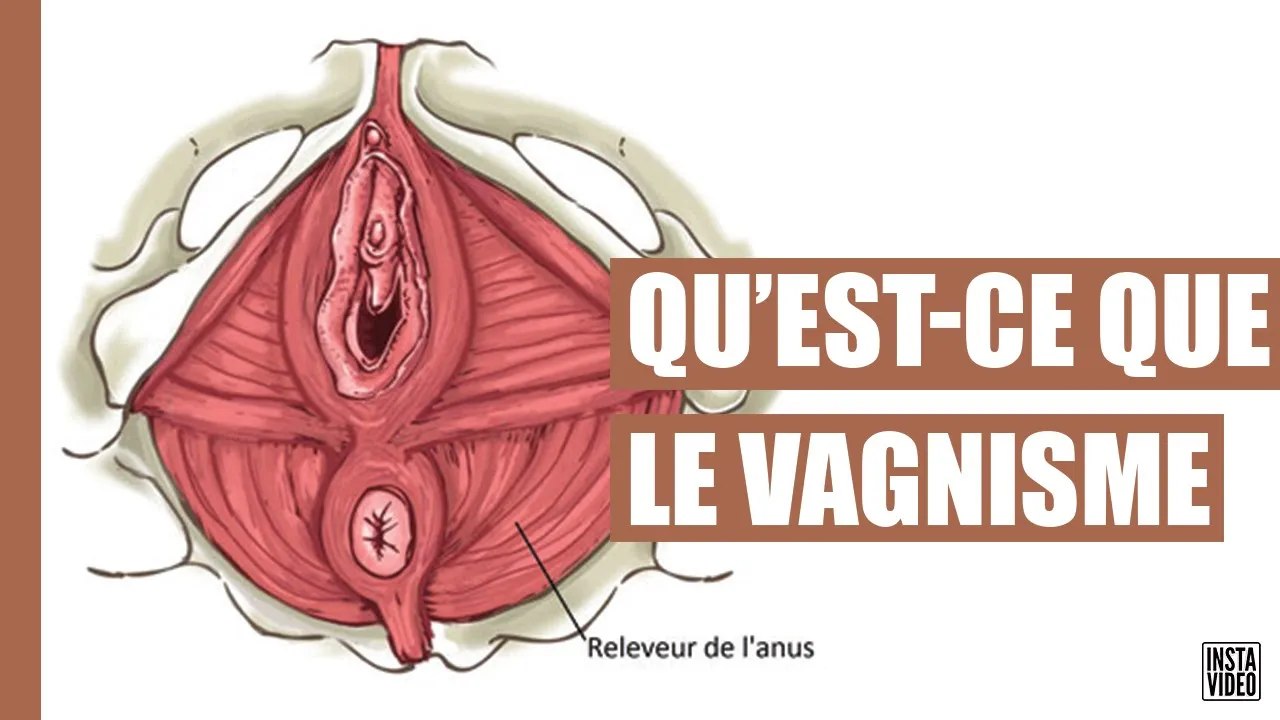 C'EST QUOI LE VAGINISME