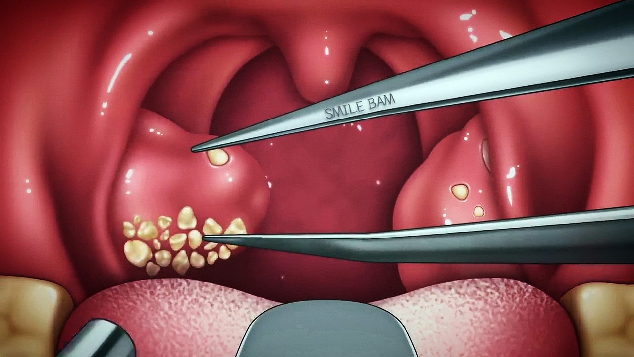 ASMR ANIMATION FOUR RILEX
