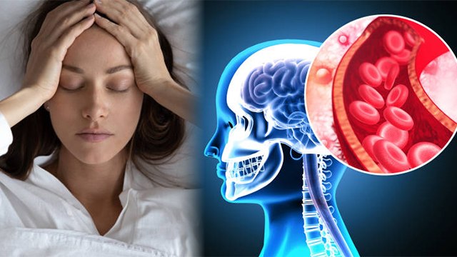 सर्दियों में सर दर्द क्यों होता है, सर्दियों में सर दर्द होने के कारण | Boldsky | *Health