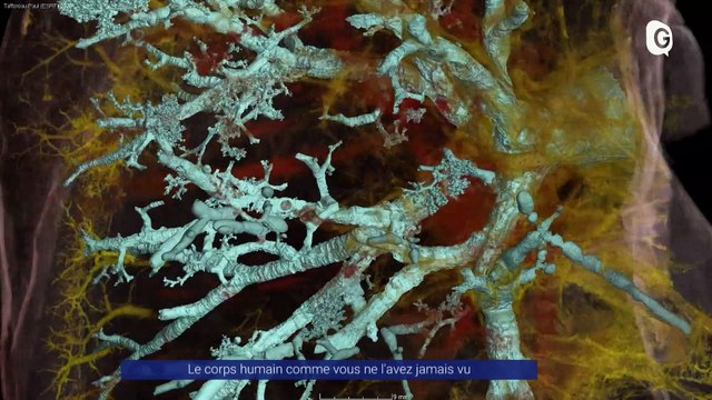 Reportage - Le corps humain comme vous ne l'avez jamais vu
