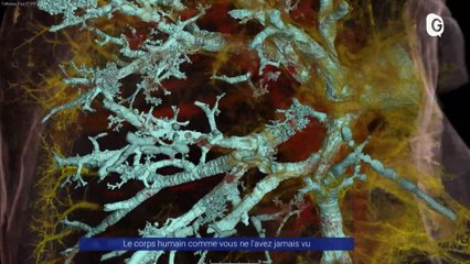 Reportage - Le corps humain comme vous ne l'avez jamais vu