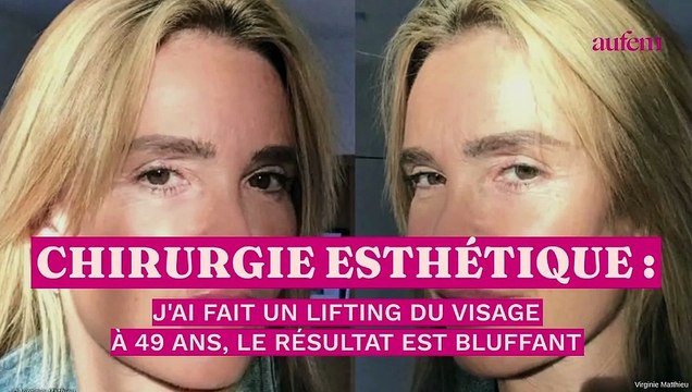 Chirurgie esthétique : j’ai fait un lifting du visage à 49 ans, le résultat est bluffant