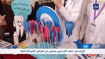 الروسان: نصف الأردنيين يعانون من أمراض الفم الشائعة