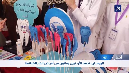 الروسان: نصف الأردنيين يعانون من أمراض الفم الشائعة