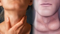 हाइपोथायरायडिज्म क्या होता है | Hypothyroidism के कारण और लक्षण क्या है | Boldsky *Health