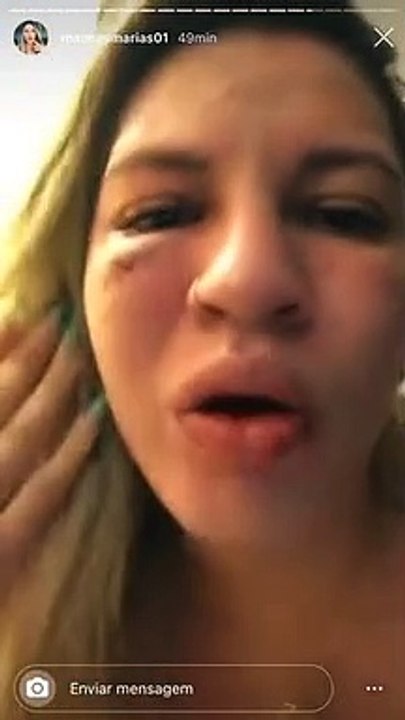 Esposa do goleiro Jean, ex-São Paulo, expõe suposta agressão do jogador; assista