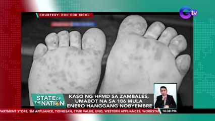 Kaso ng HFMD sa Zambales, umabot na sa 186 mula Enero hanggang Nobyembre | SONA
