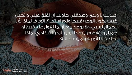 وجهي القبيح هو السبب في ما أنا عليه الآن