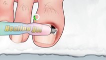 ASMR Toenail Infections And Hair Removal Foot Care Animation