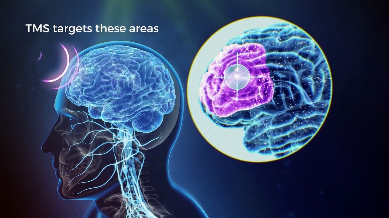 What is TMS?