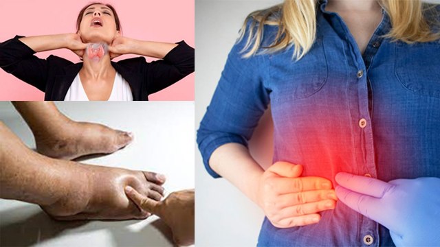 शरीर की सूजन इन गंभीर बीमारियों का संकेत है | शरीर में सूजन का कारण क्या है | Boldsky *Health